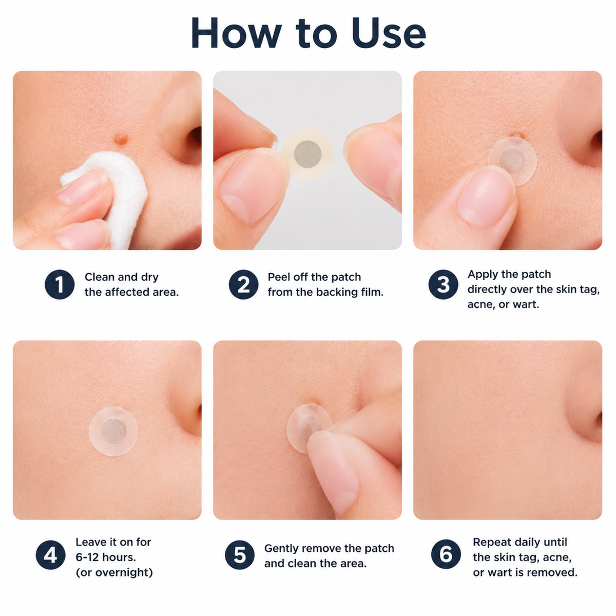 🔥NEYEROS®2-in-1 Microneedle & Hydrocolloid Patch🍀| Removes Raised Moles, Acne, Flat Warts & Skin Tags | Helps Improve Wrinkles, Scars & Blemishes | Invisible Patches for Face & Body