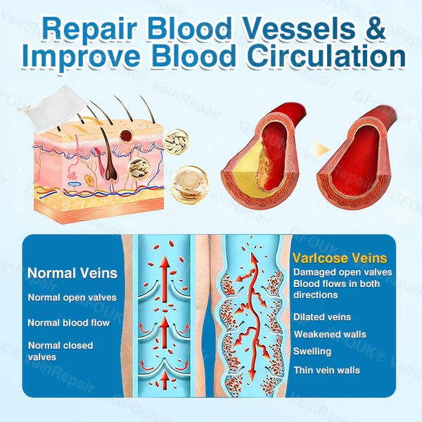 LUNOON® US✅🌱 VeinRepair Microneedle Patch Roll ⚡ Instant Relief, Long-Term Results