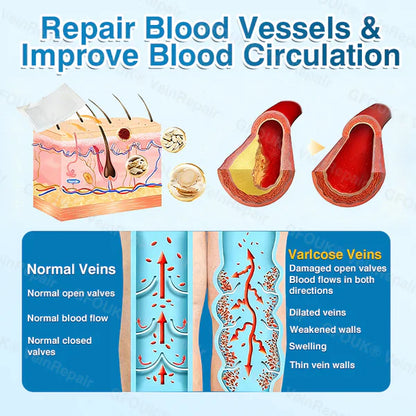 LUNOON® US✅🌱 VeinRepair Microneedle Patch Roll ⚡ Instant Relief, Long-Term Results