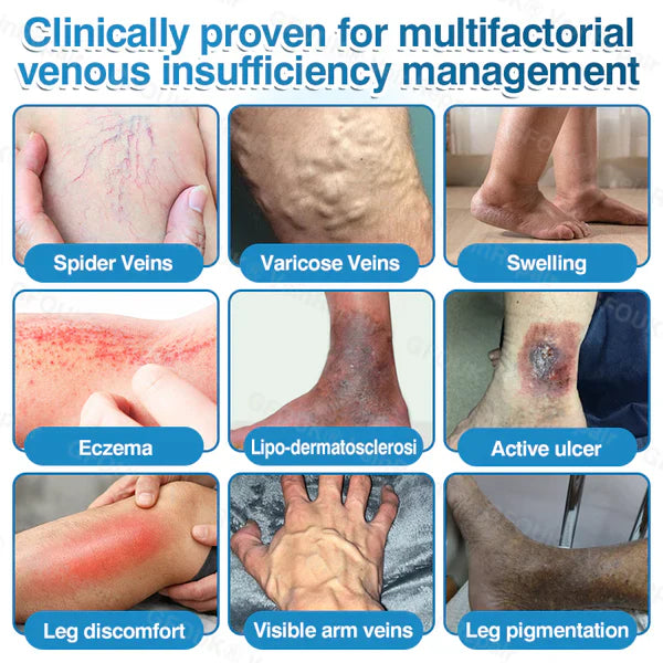 LUNOON® US✅🌱 VeinRepair Microneedle Patch Roll ⚡ Instant Relief, Long-Term Results