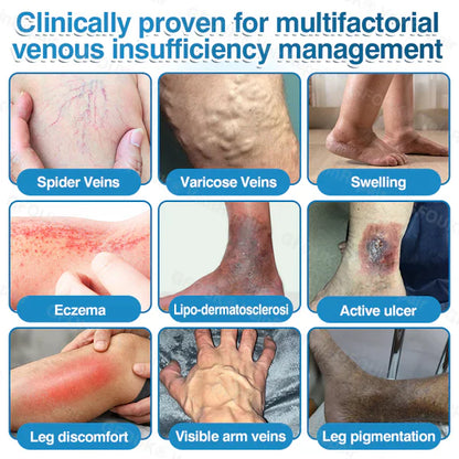 LUNOON® US✅🌱 VeinRepair Microneedle Patch Roll ⚡ Instant Relief, Long-Term Results