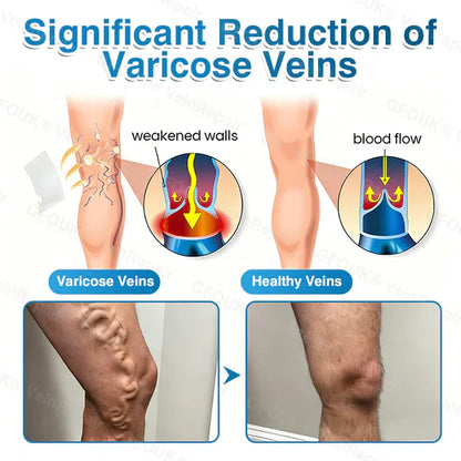 LUNOON® US✅🌱 VeinRepair Microneedle Patch Roll ⚡ Instant Relief, Long-Term Results
