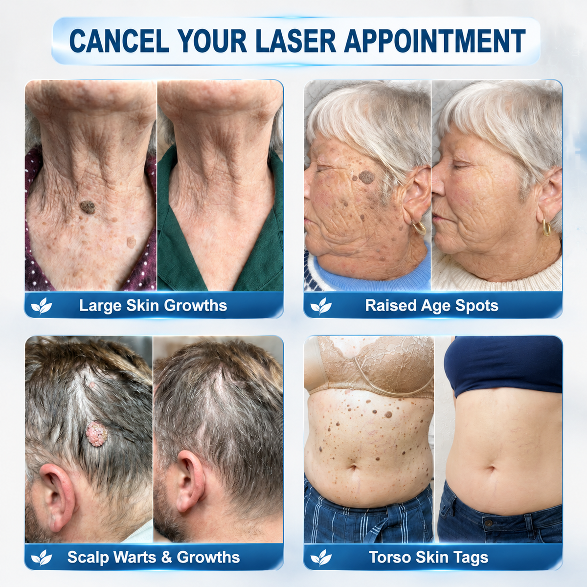 𝐎𝐟𝐟𝐢𝐜𝐢𝐚𝐥 𝐁𝐫𝐚𝐧𝐝 𝐒𝐭𝐨𝐫𝐞 |✅🎉𝐏i𝐜𝐝o® 7-𝐷𝑎𝑦 𝗧𝐚𝐠 & 𝗦𝗽𝐨𝐭 𝐄𝐫𝒂𝒔𝒆𝒓(Zero Pain, Zero 𝐒𝐜𝐚𝒓𝒔 Rollerball)