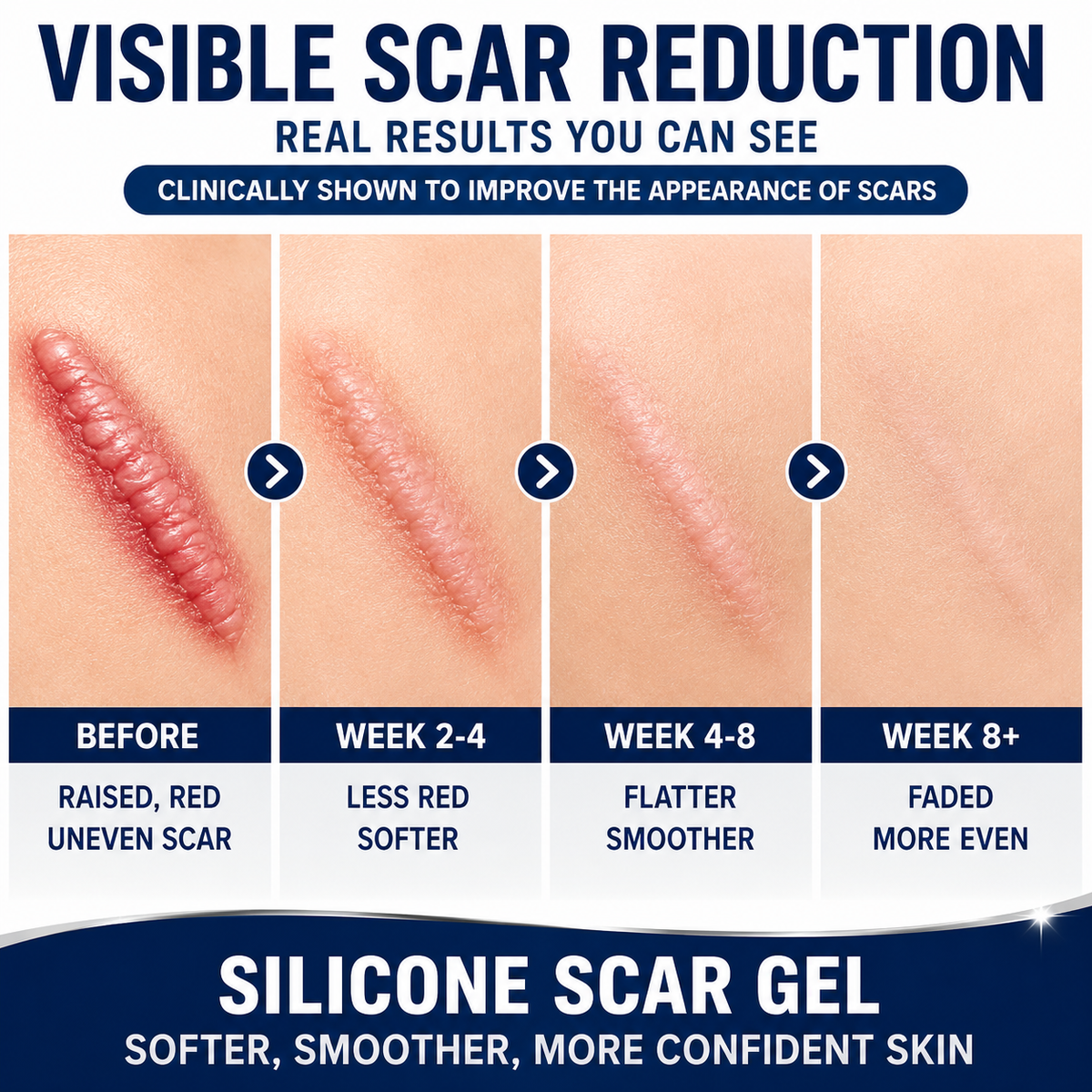 ✨ SILICONE SCAR GEL — Flatten. Soften. Fade.-Q1