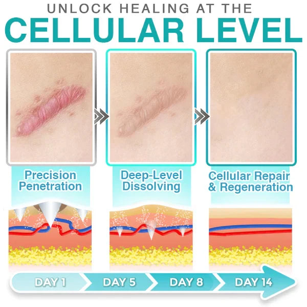 CareBreeze® 3-in-1 Scar Removal Microneedle Care Patch 💡