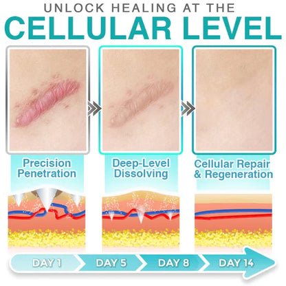 CareBreeze® 3-in-1 Scar Removal Microneedle Care Patch 💡
